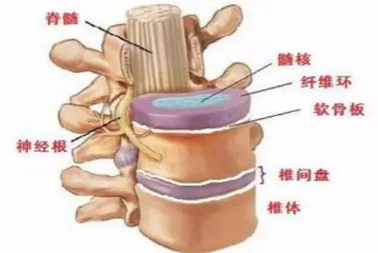 牽引床